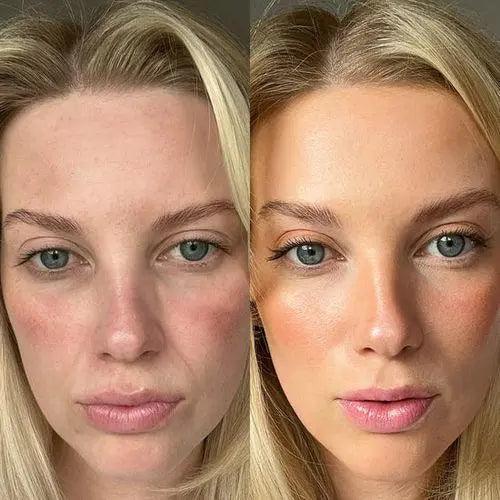 GlowLift Face & Neck Tool