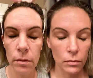 LUXIZ™ - Get a firmer and tighter face naturally Luxiz™️