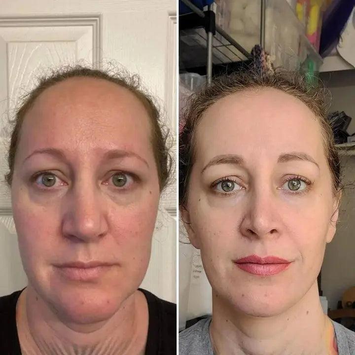 LUXIZ™ - Get a firmer and tighter face naturally Luxiz™️