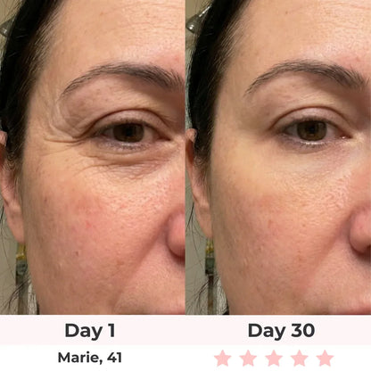 7-in-1 LED Facial Sculptor