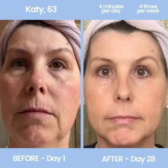 LUXIZ™ - Get a firmer and tighter face naturally Luxiz™️