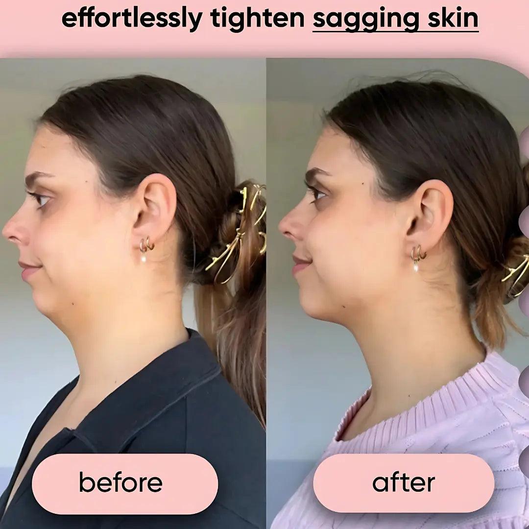 VivaLift 4-in-1 Face Shaper Luxiz™️