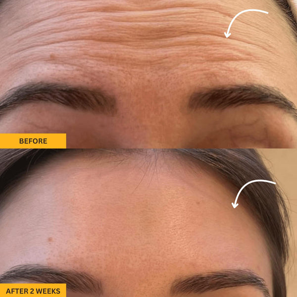 Lymphatic Contour Brush
