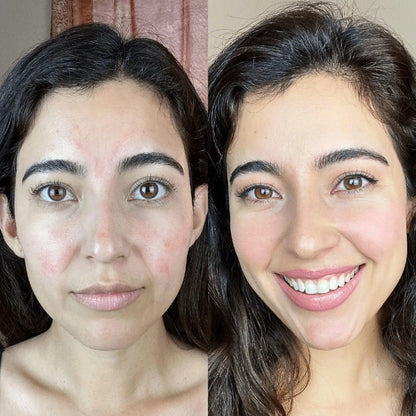 GlowLift Gesichtssculptor Pro