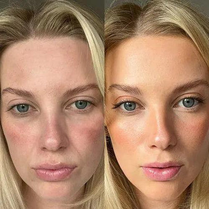 GlowLift Gesichtssculptor Pro