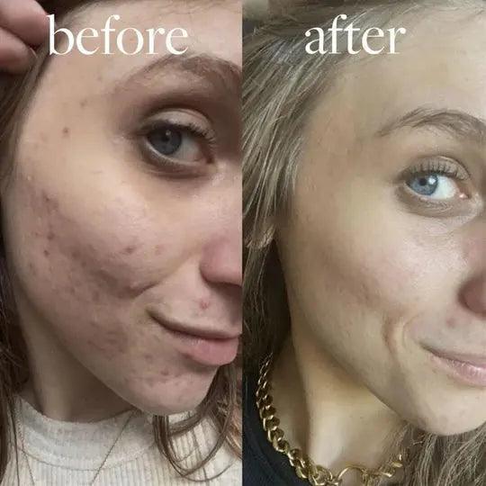 GlowLift Gesichtssculptor Pro