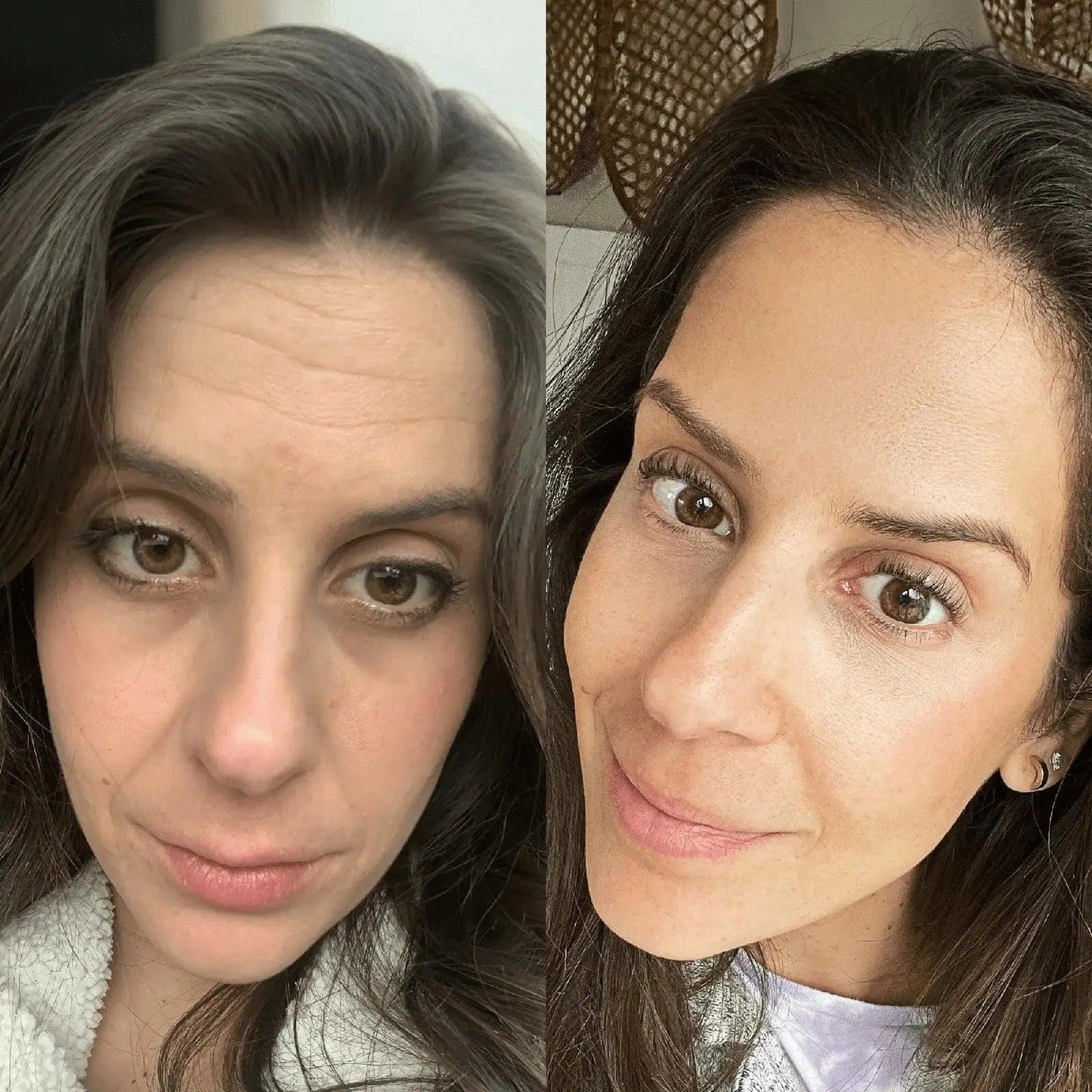 GlowLift Gesichtssculptor Pro