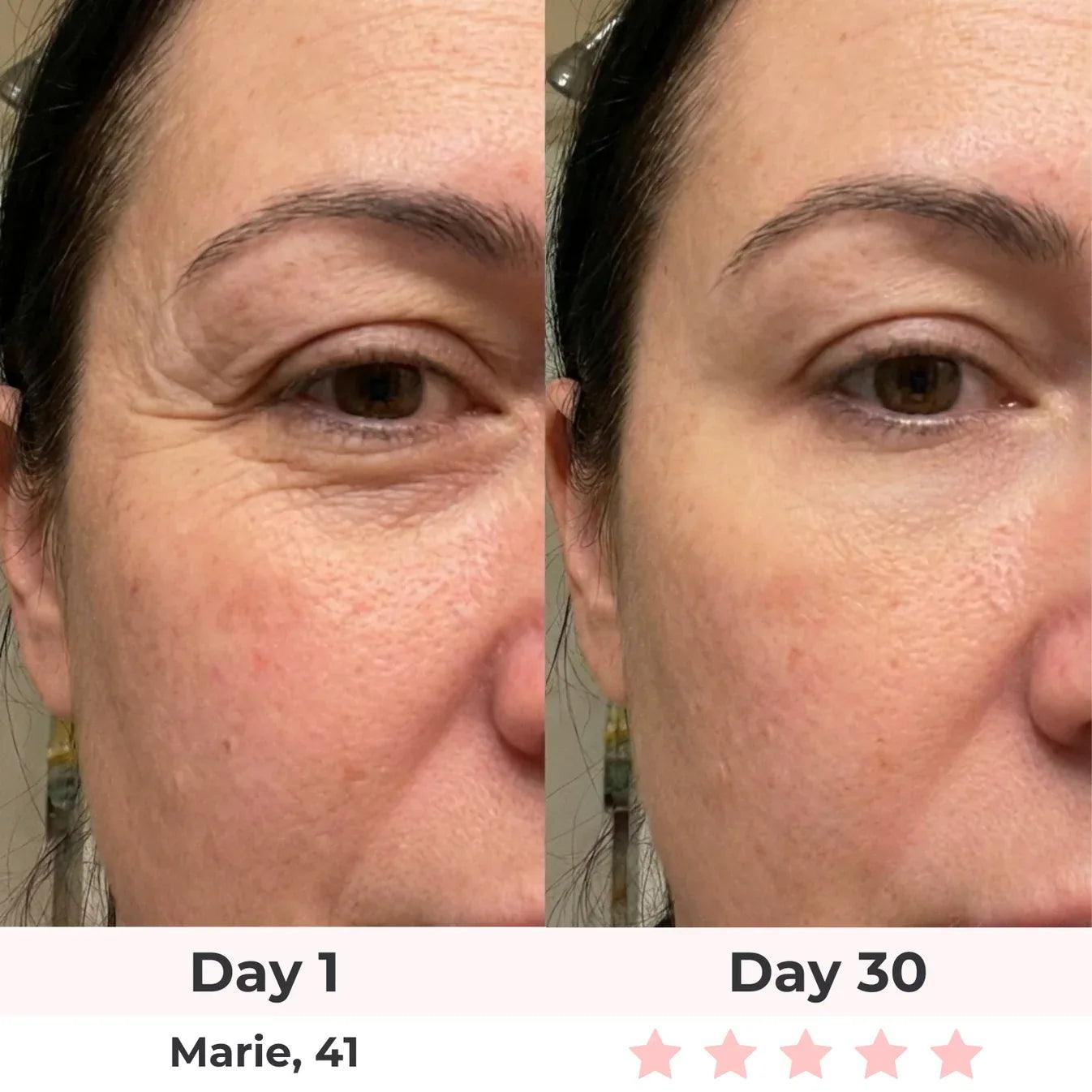 GlowLift Gesichtssculptor Pro