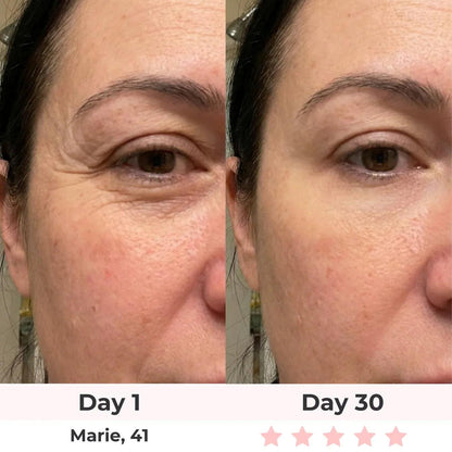 GlowLift Gesichtssculptor Pro