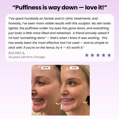 Luxiz™ Glow Sculpt - Beauty Roller Luxiz™️