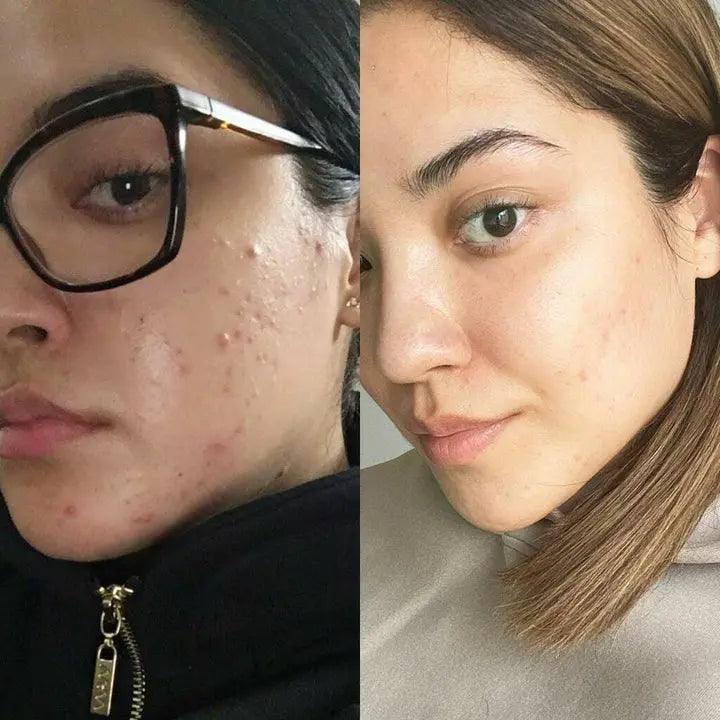 GlowLift Gesichtssculptor Pro