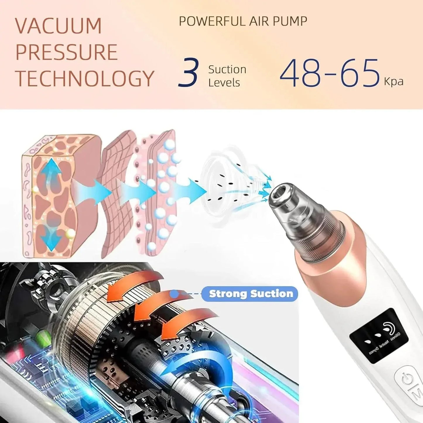 Blackhead Remover Tool for Clear Skin (Pore Vacuum Cleaner)
