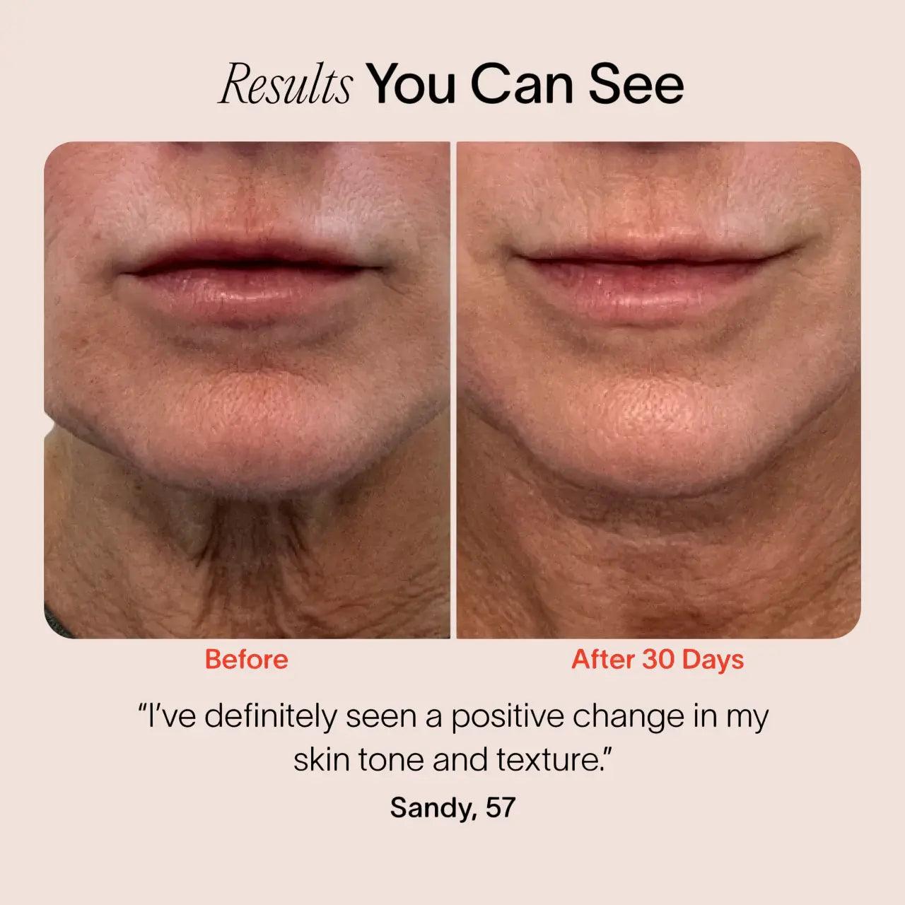 Radiant Skin Facial Sculptor Luxiz™️