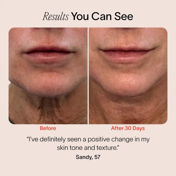 Radiant Skin Facial Sculptor Luxiz™️
