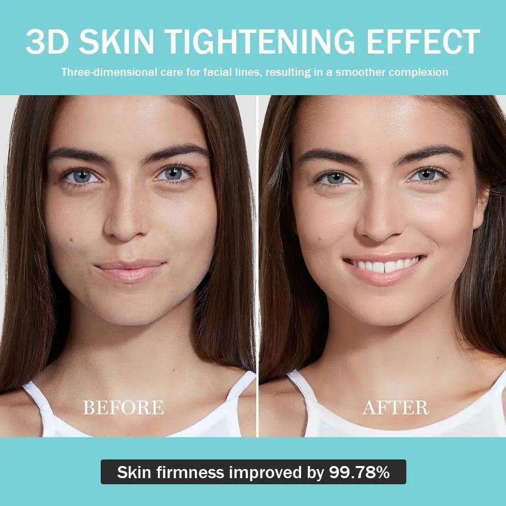 Luxiz™ 6-in-1 Rejuvenation Device Luxiz™️